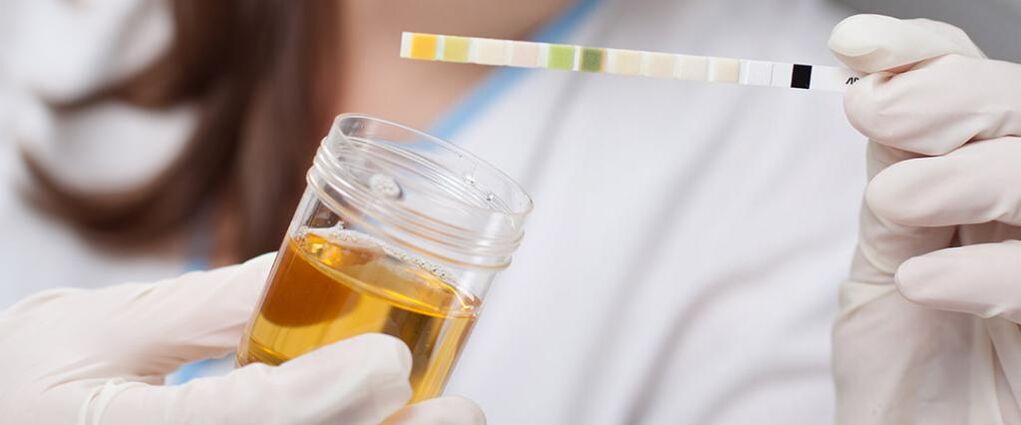 urine test for prostatitis